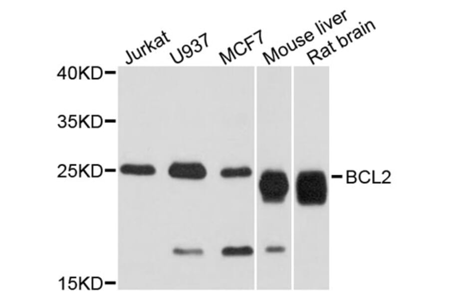 Western Blot - Anti-BCL2 Antibody (A2212) - Antibodies.com