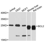 Western Blot - Anti-BCL2 Antibody (A2212) - Antibodies.com