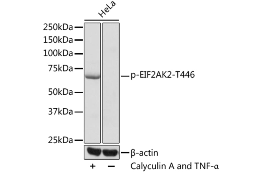 Western Blot - Anti-EIF2AK2 (phospho T446) Antibody (AP0632) - Antibodies.com
