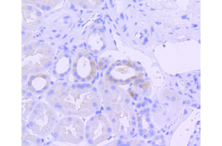 Immunohistochemistry - Anti-EIF2AK2 (phospho T446) Antibody (AP0632) - Antibodies.com
