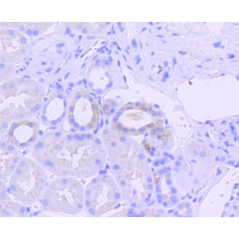 Immunohistochemistry - Anti-EIF2AK2 (phospho T446) Antibody (AP0632) - Antibodies.com