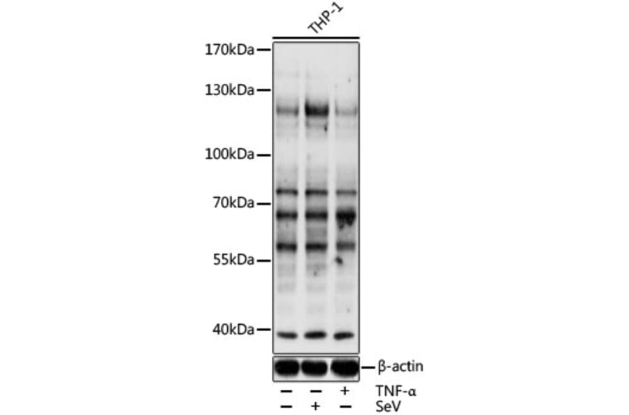 Western Blot - Anti-pan phospho Tyrosine Antibody (AP0626) - Antibodies.com
