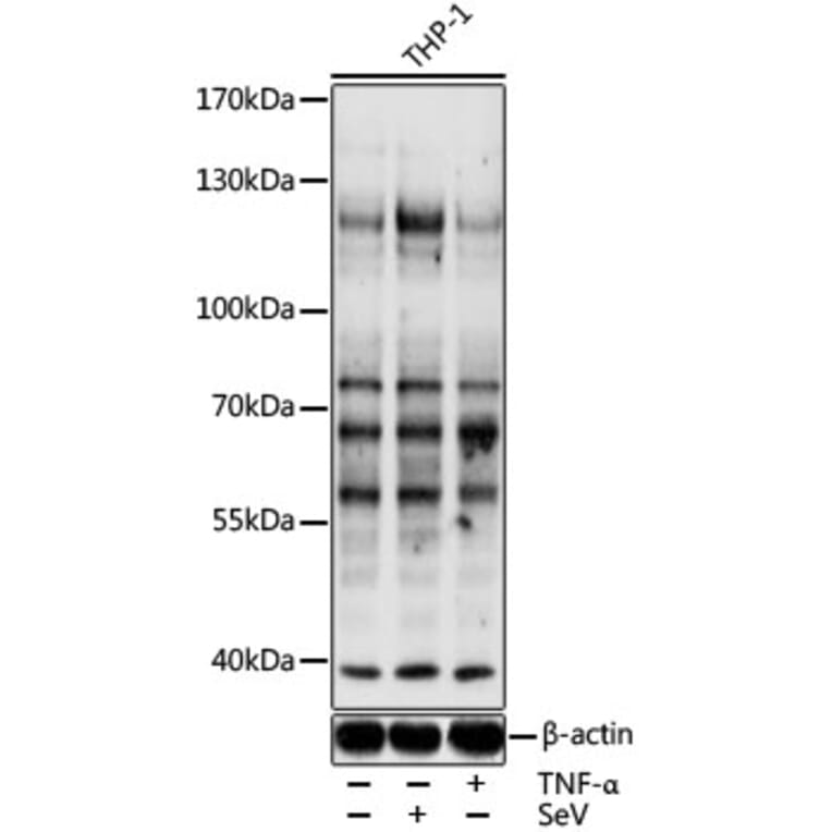Western Blot - Anti-pan phospho Tyrosine Antibody (AP0626) - Antibodies.com