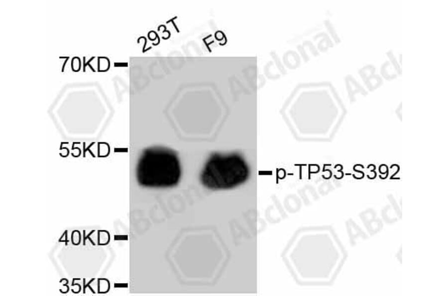 Western Blot - Anti-TP53 (phospho S392) Antibody (AP0641) - Antibodies.com