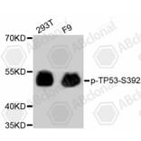 Western Blot - Anti-TP53 (phospho S392) Antibody (AP0641) - Antibodies.com