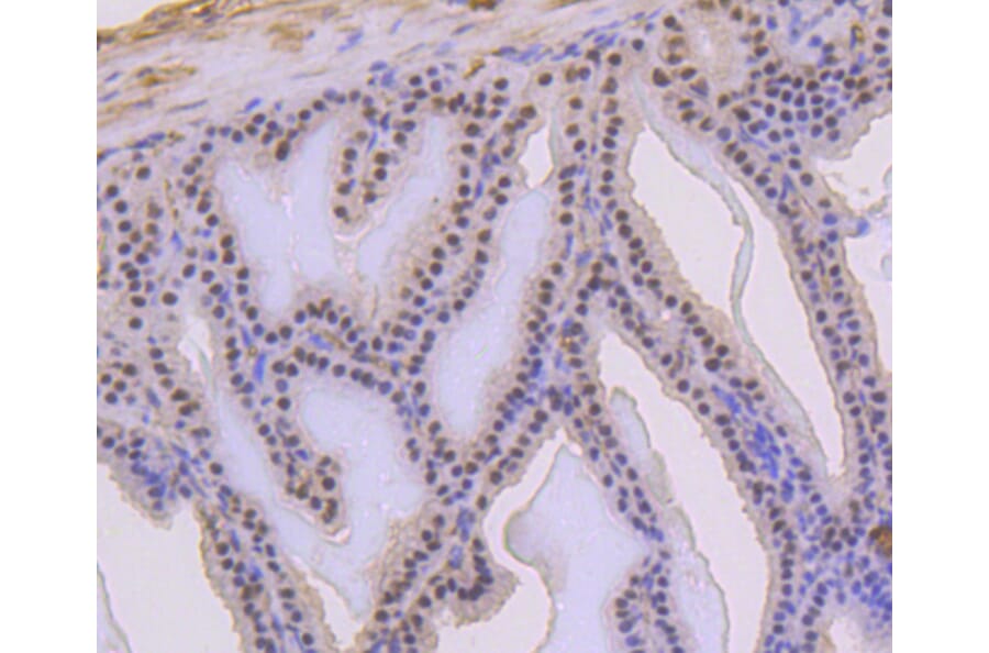 Immunohistochemistry - Anti-TP53 (phospho S392) Antibody (AP0641) - Antibodies.com