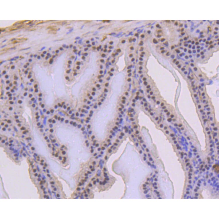 Immunohistochemistry - Anti-TP53 (phospho S392) Antibody (AP0641) - Antibodies.com