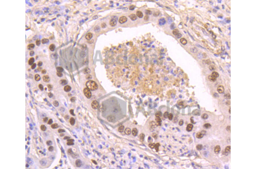 Immunohistochemistry - Anti-TP53 (phospho S392) Antibody (AP0641) - Antibodies.com