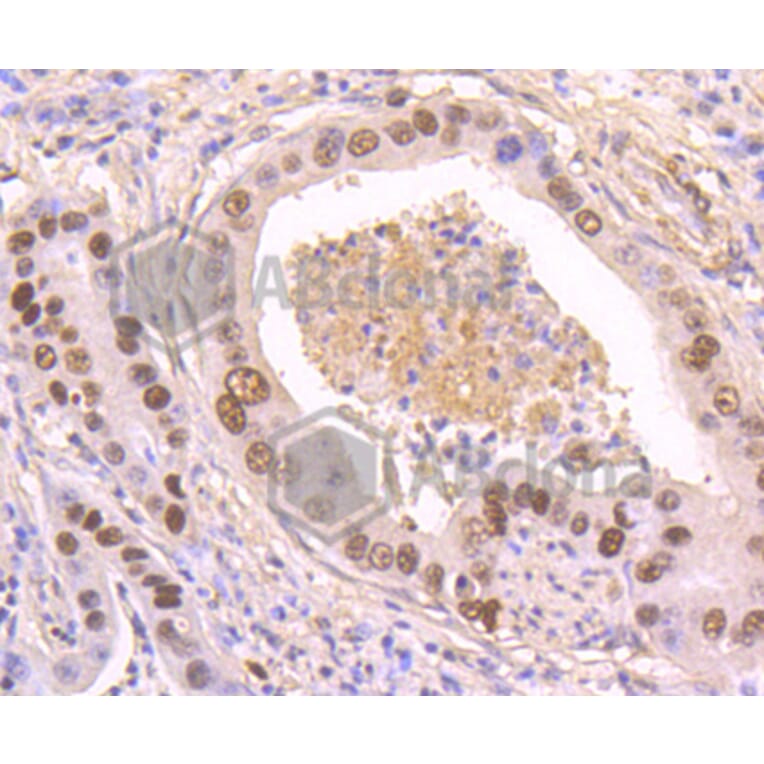 Immunohistochemistry - Anti-TP53 (phospho S392) Antibody (AP0641) - Antibodies.com