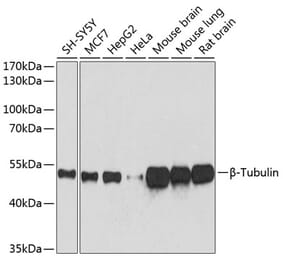 Western Blot - Anti-beta Tubulin Antibody [AMC0498] (A80389) - Antibodies.com