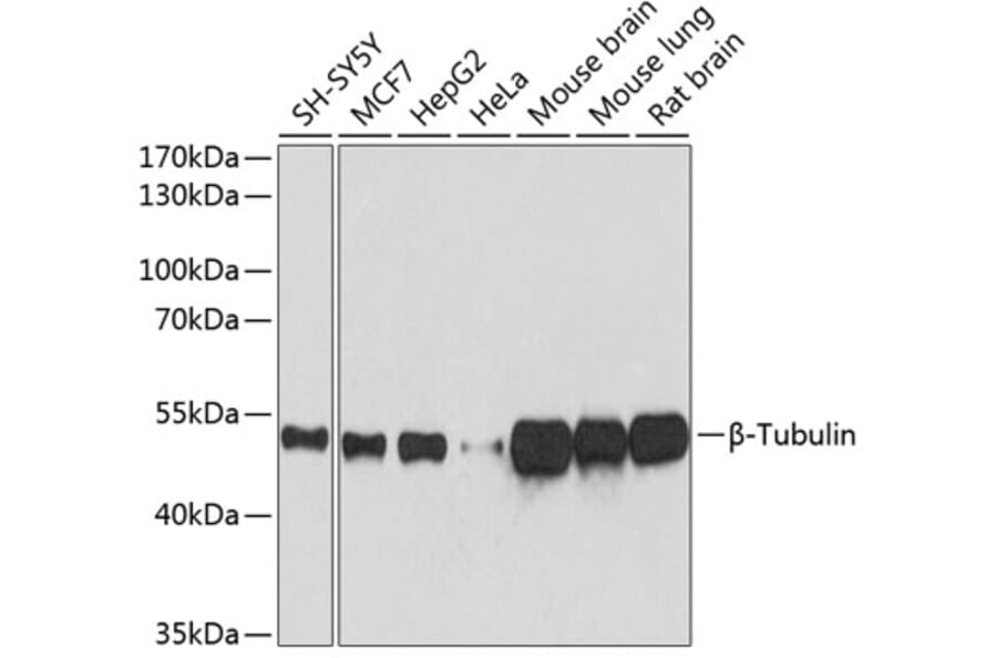Western Blot - Anti-beta Tubulin Antibody [AMC0498] (A80389) - Antibodies.com