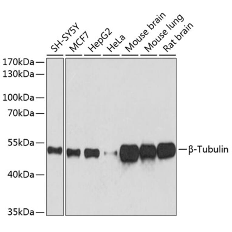 Western Blot - Anti-beta Tubulin Antibody [AMC0498] (A80389) - Antibodies.com