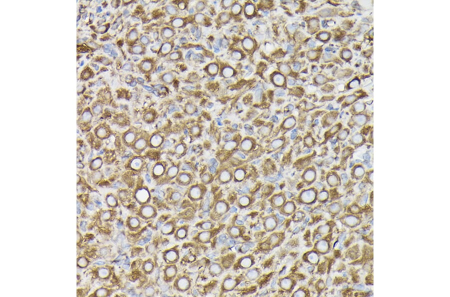 Immunohistochemistry - Anti-beta Tubulin Antibody [AMC0498] (A80389) - Antibodies.com