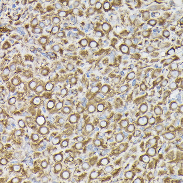 Immunohistochemistry - Anti-beta Tubulin Antibody [AMC0498] (A80389) - Antibodies.com