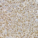 Immunohistochemistry - Anti-beta Tubulin Antibody [AMC0498] (A80389) - Antibodies.com
