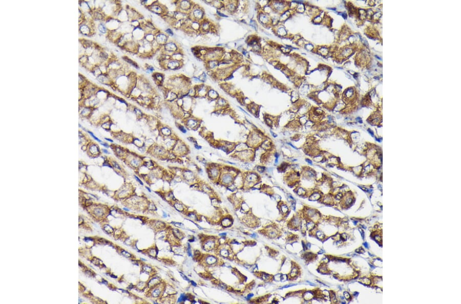 Immunohistochemistry - Anti-beta Tubulin Antibody [AMC0498] (A80389) - Antibodies.com