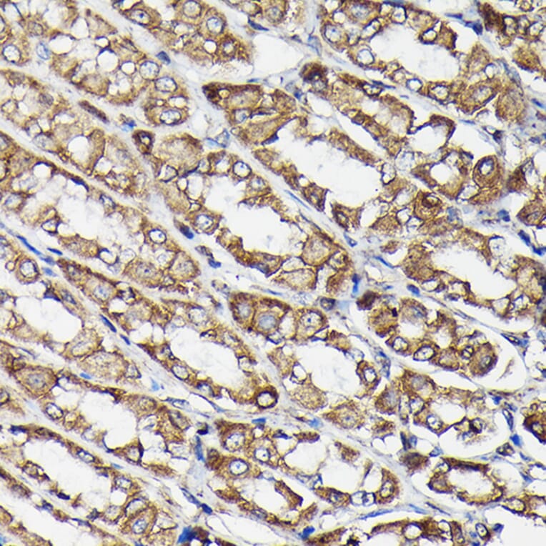 Immunohistochemistry - Anti-beta Tubulin Antibody [AMC0498] (A80389) - Antibodies.com
