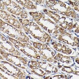 Immunohistochemistry - Anti-beta Tubulin Antibody [AMC0498] (A80389) - Antibodies.com