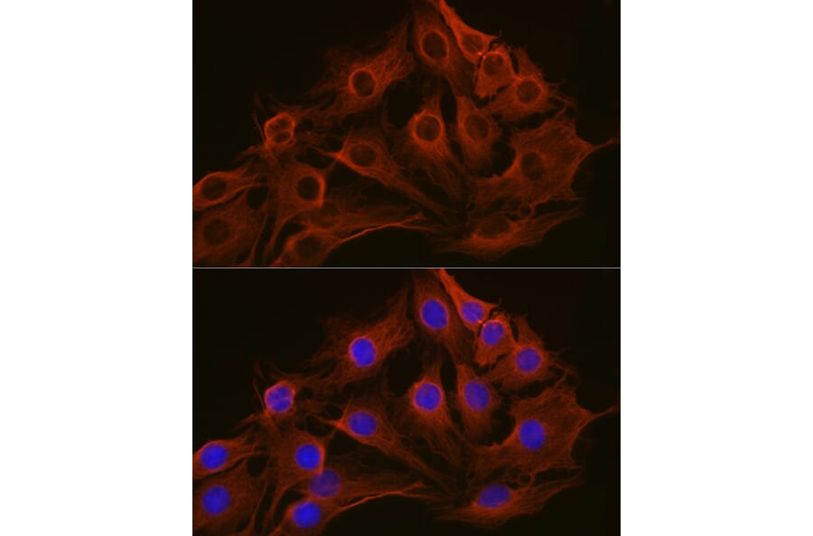 Immunofluorescence - Anti-beta Tubulin Antibody [AMC0498] (A80389) - Antibodies.com