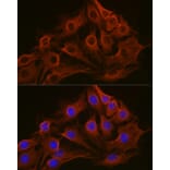 Immunofluorescence - Anti-beta Tubulin Antibody [AMC0498] (A80389) - Antibodies.com
