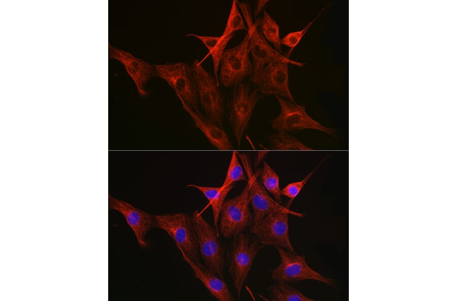 Immunofluorescence - Anti-beta Tubulin Antibody [AMC0498] (A80389) - Antibodies.com