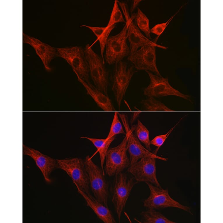 Immunofluorescence - Anti-beta Tubulin Antibody [AMC0498] (A80389) - Antibodies.com