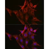Immunofluorescence - Anti-beta Tubulin Antibody [AMC0498] (A80389) - Antibodies.com