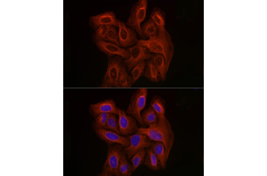 Immunofluorescence - Anti-beta Tubulin Antibody [AMC0498] (A80389) - Antibodies.com