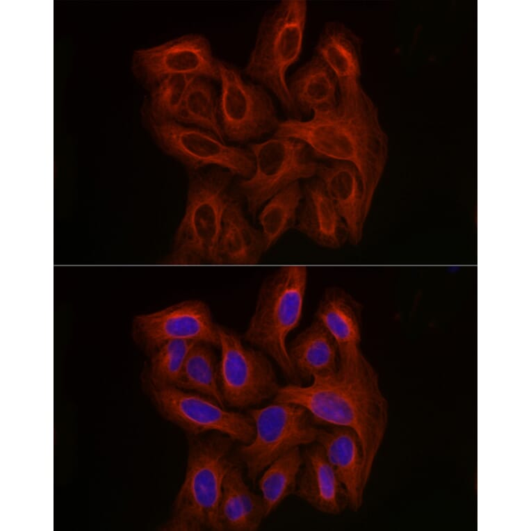 Immunofluorescence - Anti-beta Tubulin Antibody [AMC0498] (A80389) - Antibodies.com