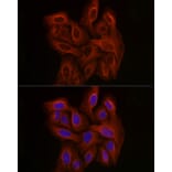 Immunofluorescence - Anti-beta Tubulin Antibody [AMC0498] (A80389) - Antibodies.com