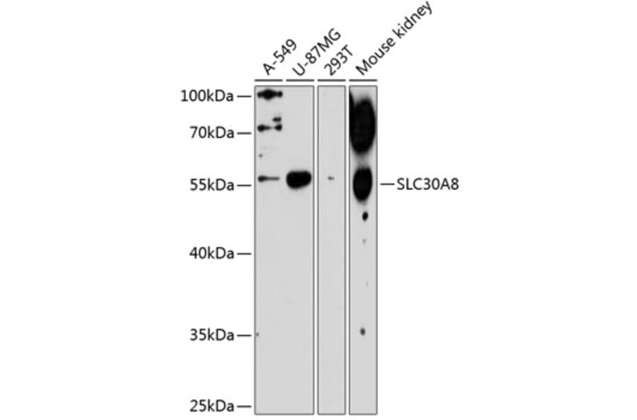 Western Blot - Anti-SLC30A8 Antibody (A1679) - Antibodies.com