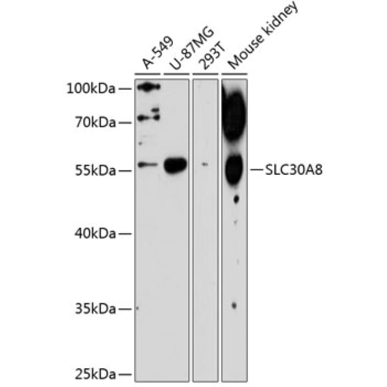 Western Blot - Anti-SLC30A8 Antibody (A1679) - Antibodies.com