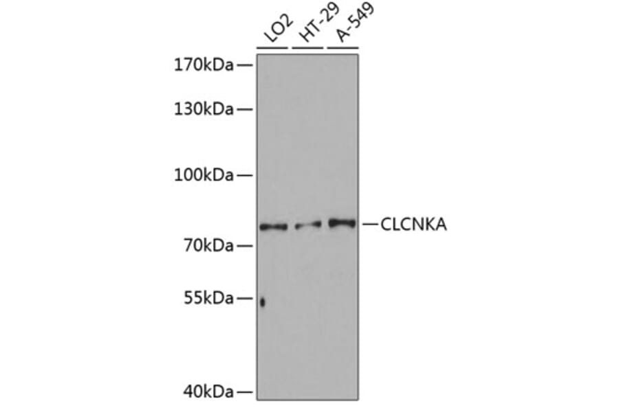 Western Blot - Anti-CLCNKA Antibody (A80391) - Antibodies.com