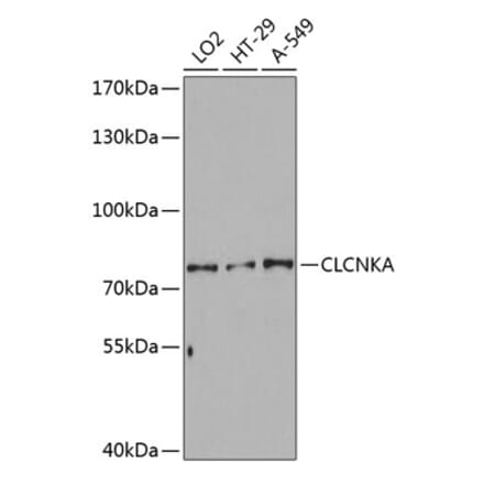 Western Blot - Anti-CLCNKA Antibody (A80391) - Antibodies.com