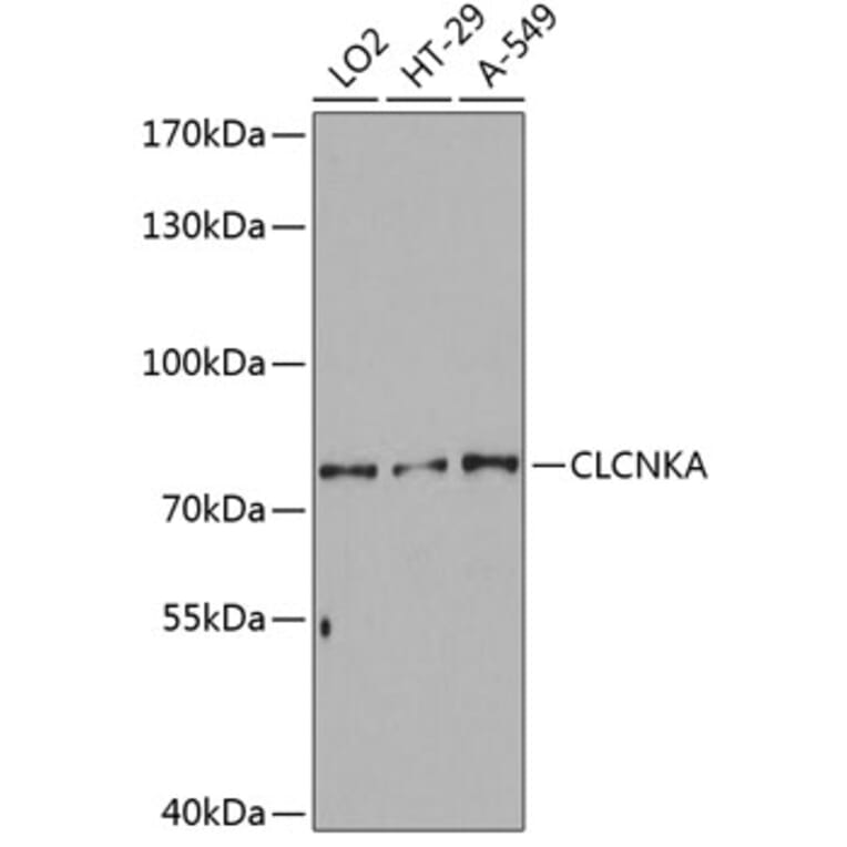 Western Blot - Anti-CLCNKA Antibody (A80391) - Antibodies.com