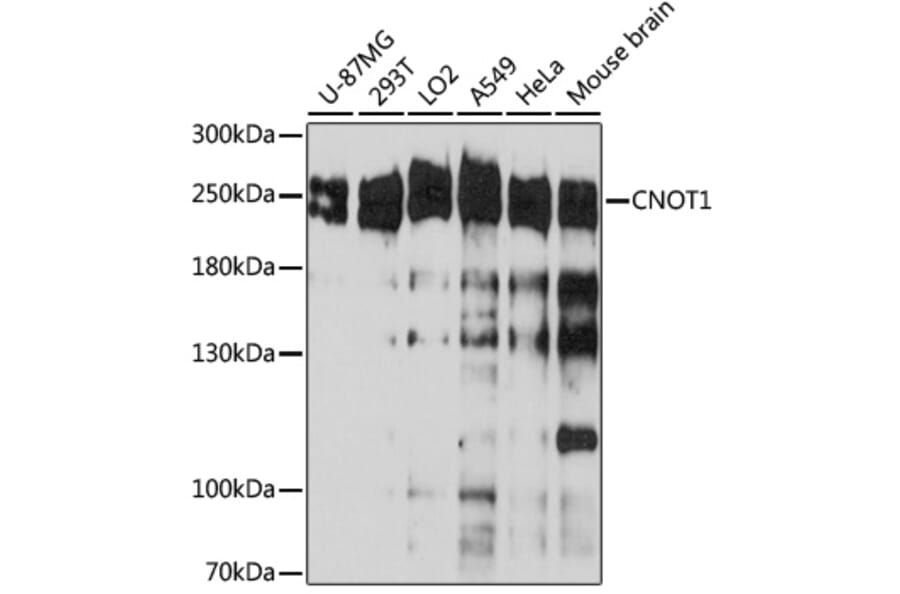 Western Blot - Anti-CNOT1 Antibody (A80395) - Antibodies.com
