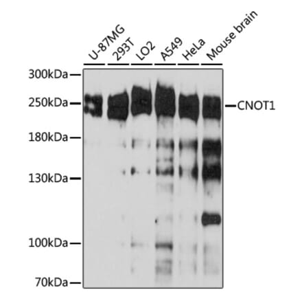Western Blot - Anti-CNOT1 Antibody (A80395) - Antibodies.com