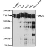 Western Blot - Anti-CNOT1 Antibody (A80395) - Antibodies.com