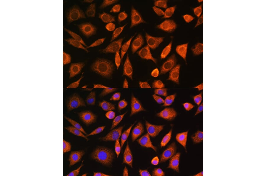 Immunofluorescence - Anti-CNOT1 Antibody (A80395) - Antibodies.com