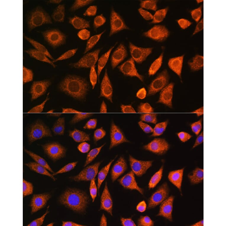 Immunofluorescence - Anti-CNOT1 Antibody (A80395) - Antibodies.com