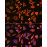 Immunofluorescence - Anti-CNOT1 Antibody (A80395) - Antibodies.com