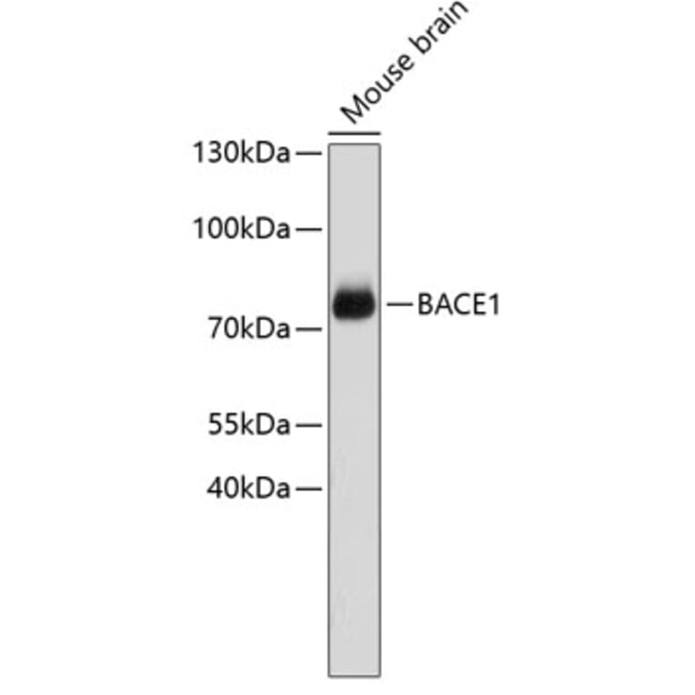 Western Blot - Anti-BACE1 Antibody (A7229) - Antibodies.com