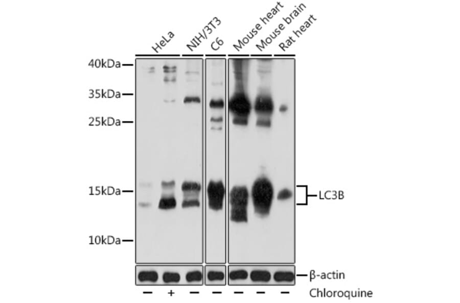Western Blot - Anti-LC3B Antibody (A80400) - Antibodies.com