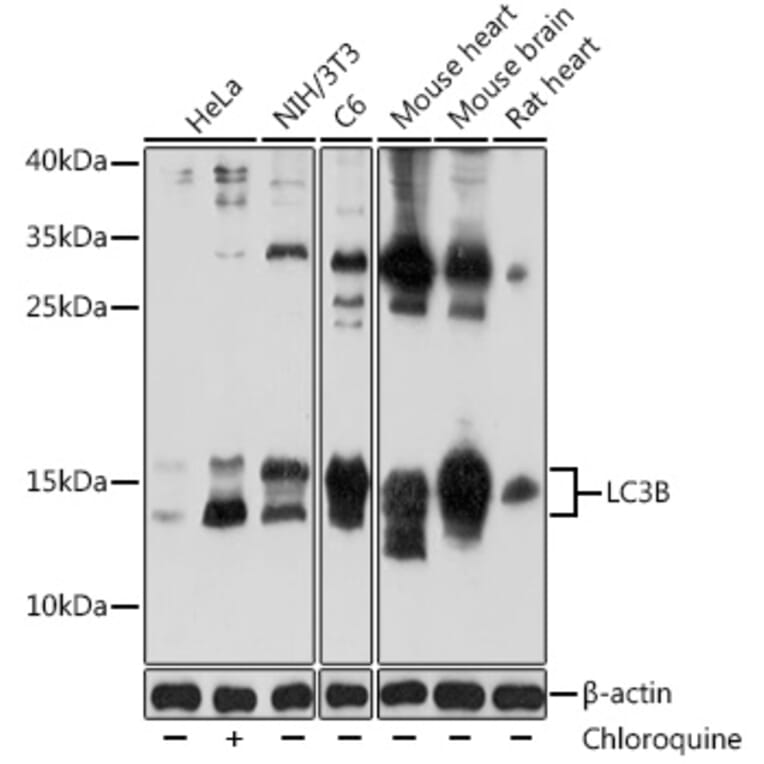 Western Blot - Anti-LC3B Antibody (A80400) - Antibodies.com