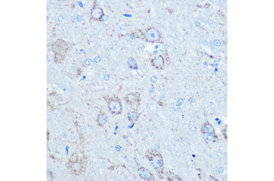 Immunohistochemistry - Anti-LC3B Antibody (A80400) - Antibodies.com