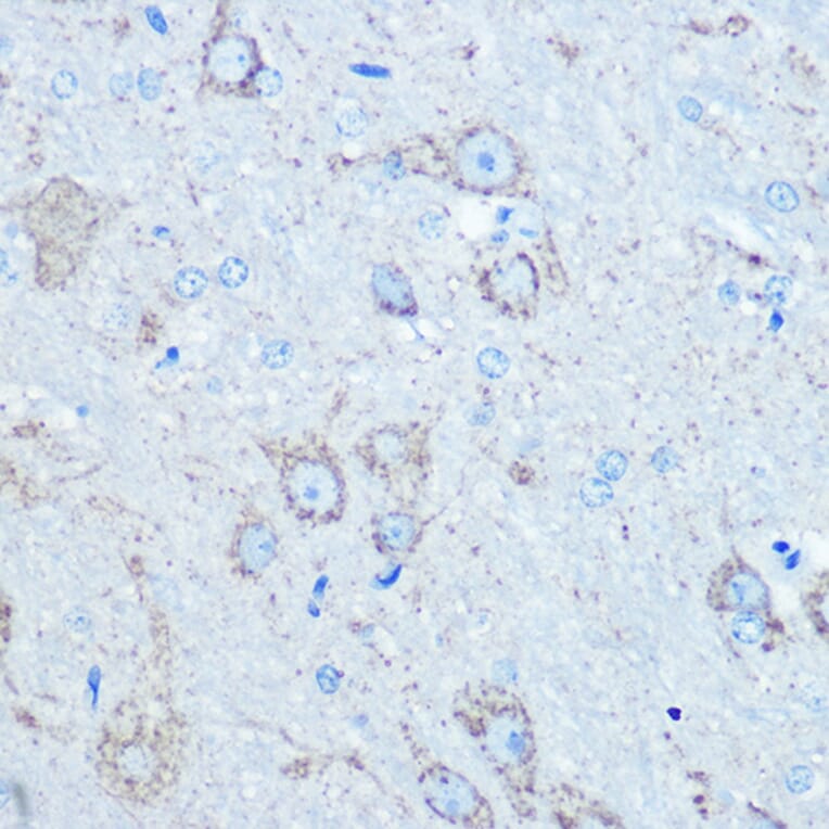 Immunohistochemistry - Anti-LC3B Antibody (A80400) - Antibodies.com