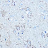 Immunohistochemistry - Anti-LC3B Antibody (A80400) - Antibodies.com