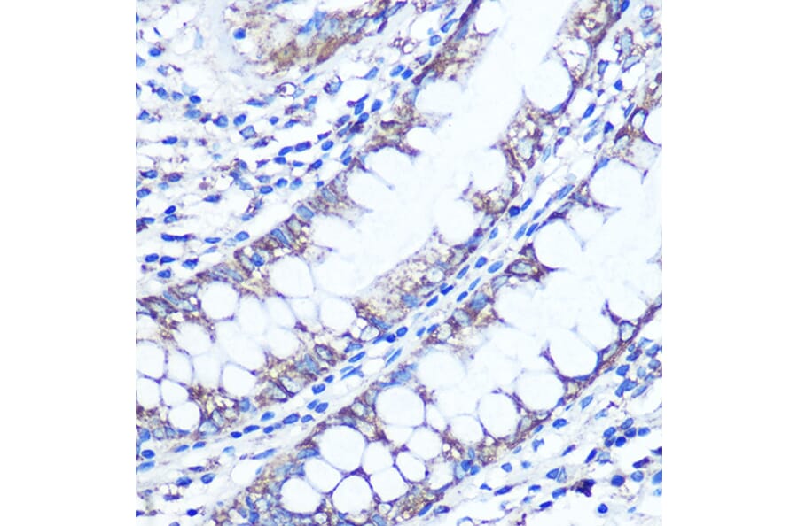 Immunohistochemistry - Anti-LC3B Antibody (A80400) - Antibodies.com