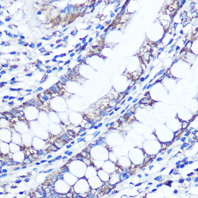 Immunohistochemistry - Anti-LC3B Antibody (A80400) - Antibodies.com