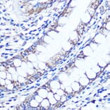 Immunohistochemistry - Anti-LC3B Antibody (A80400) - Antibodies.com